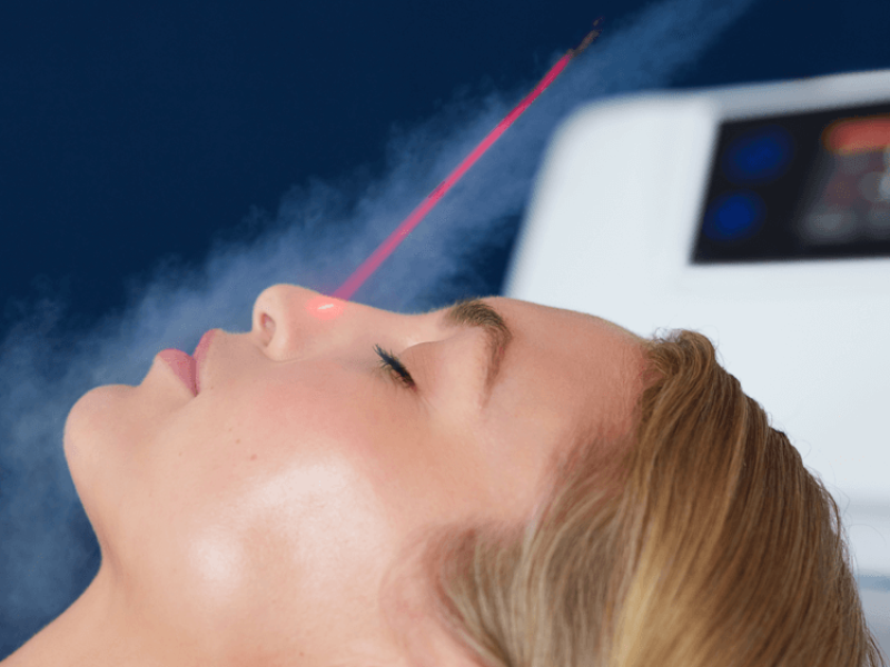 Cryo_2